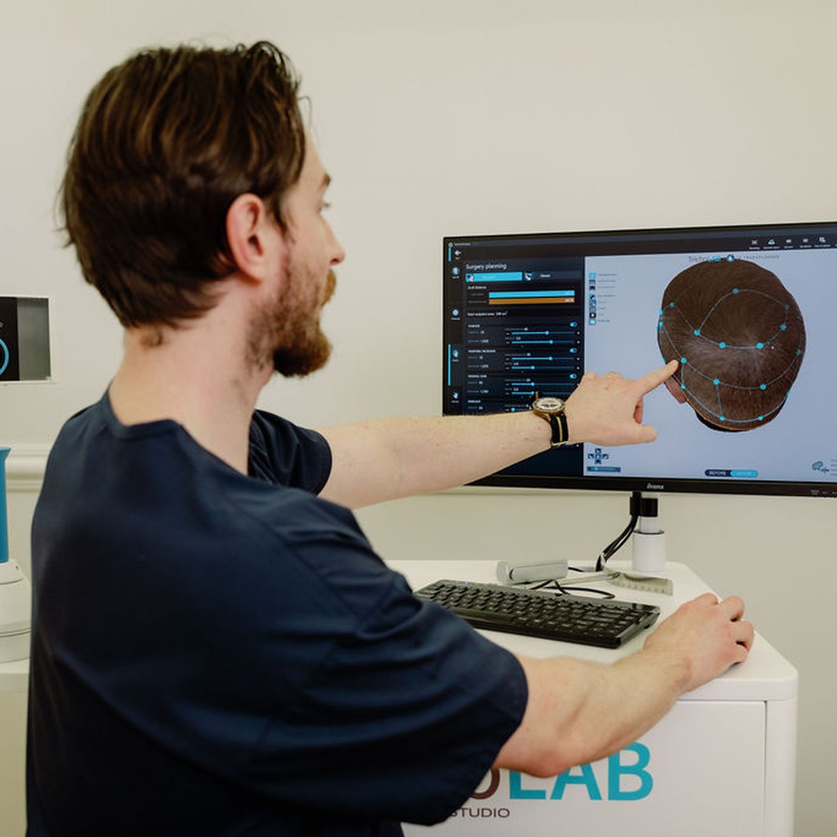 Dr Alex reviewing a patient's magnified trichoscopy image on screen at 3D Hair Transplant